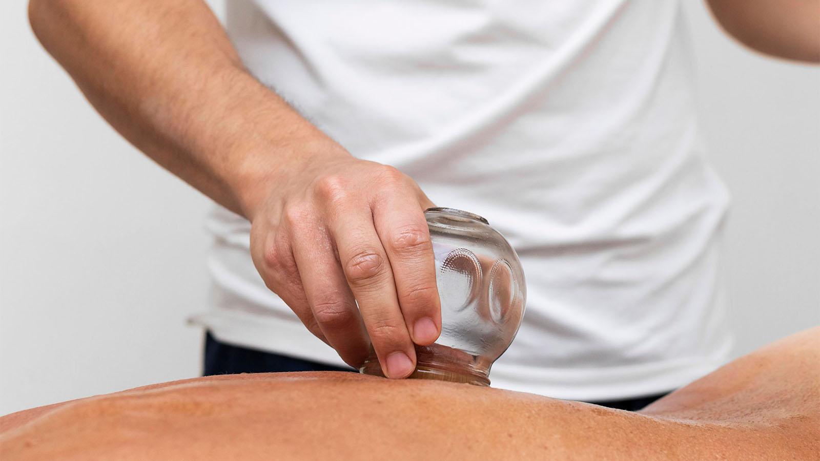 Cupping